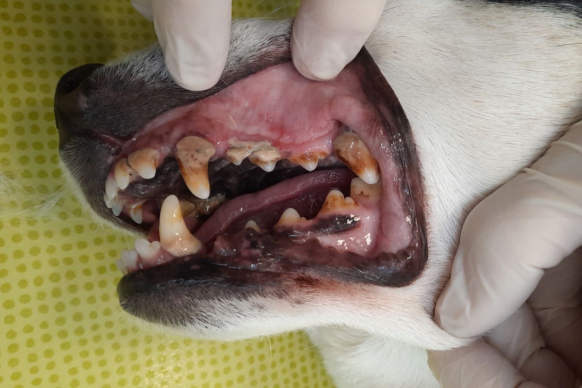 Avant le détartrage : des dents couvertes de tartre